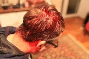 20 лютого під час виконання професійних обов'язків фотокору Ігорю Єфімову проломили голову фото imi.org.ua
